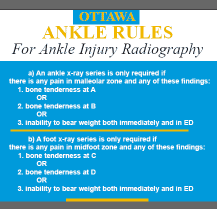 Ottawa Ankle Rules