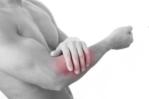 Effetti delle infiltrazioni di corticosteroidi, della fisioterapia, o di entrambi nell’epicondilalgia laterale Effetti delle infiltrazioni di corticosteroidi, della fisioterapia, o di entrambi nell’epicondilalgia laterale