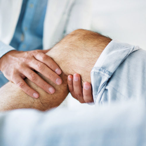 Le regole di Ottawa e di Pittsburgh riducono le radiografie non necessarie dopo un trauma al ginocchio?